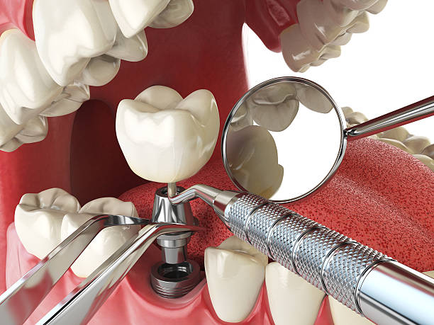 Best Knocked-Out Tooth Emergency  in Welcome, NC